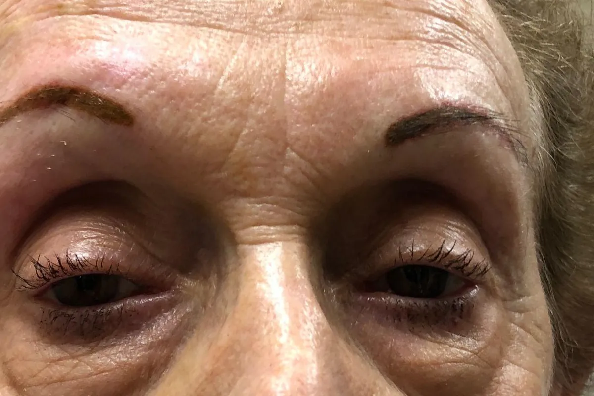 After: the same client immediately after the procedure, with defined warm brown brows