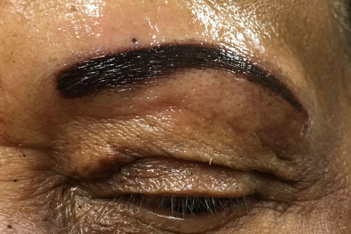 After: the same eyebrow immediately after the procedure, with a bold, dark, defined shape