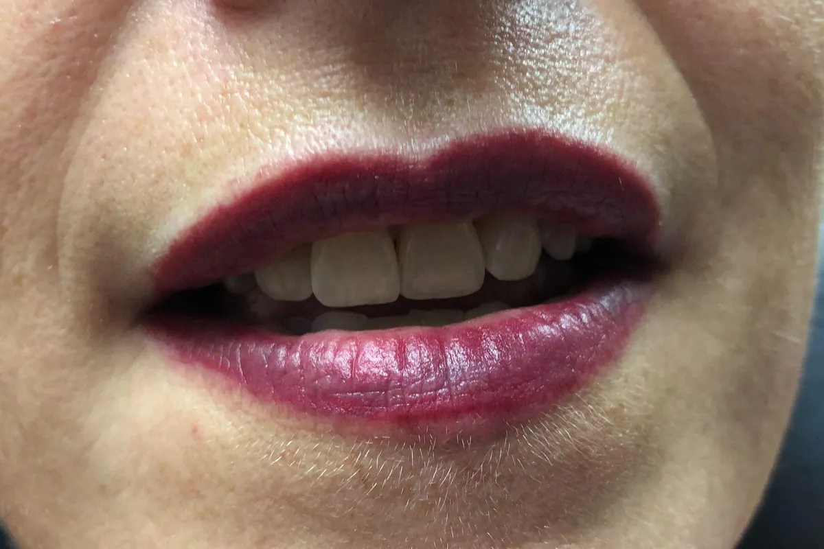 After: the same lips immediately after the procedure in a deeper berry color with a defined edge
