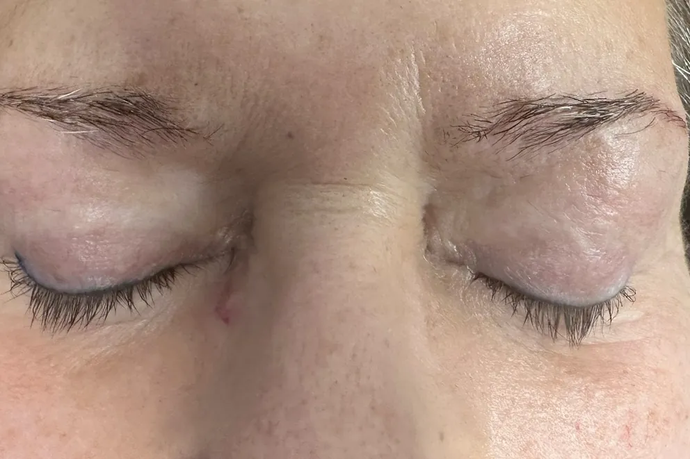 Before: a client's eyes closed, with natural lashes and no eyeliner