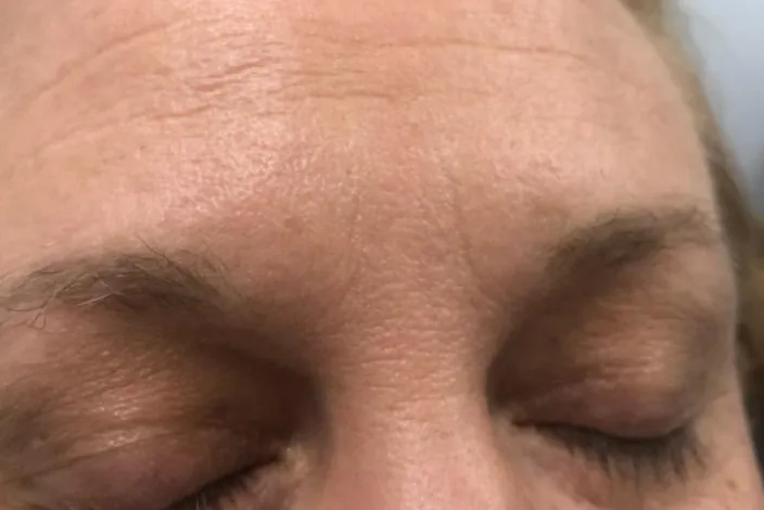 Before: a client's faint, light brows, eyes closed