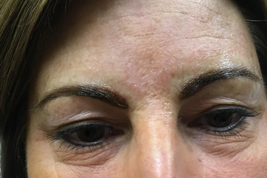 After: the same client immediately after the procedure, with darker, defined brows