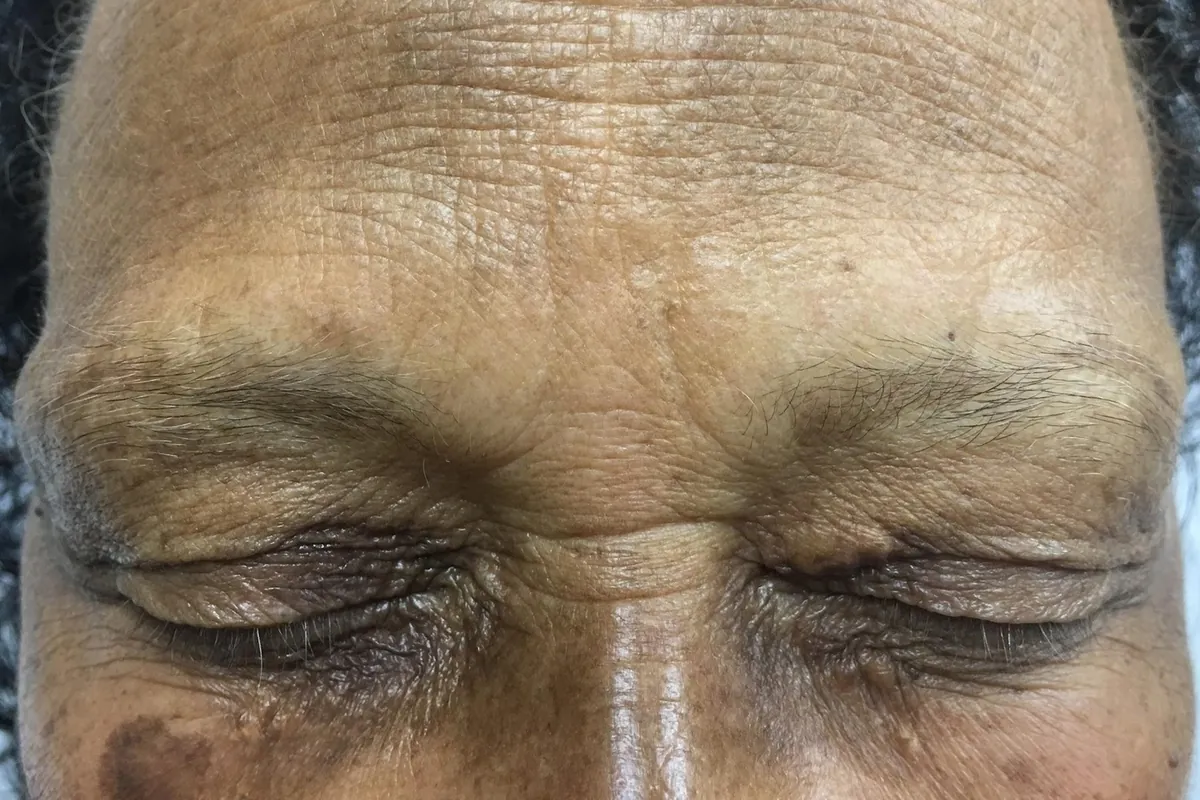 Before: a client's faded, grayish brows, eyes closed